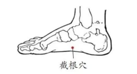 截根穴位置|实战中医讲堂：截根疗法简介及几种疾病的操作方法